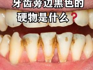 黑硬的物质【黑硬的物质是什么？它有什么用？】